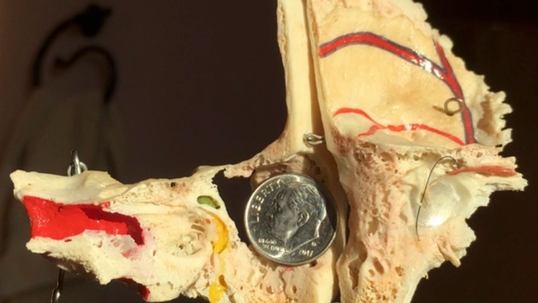Temporal Bone Review